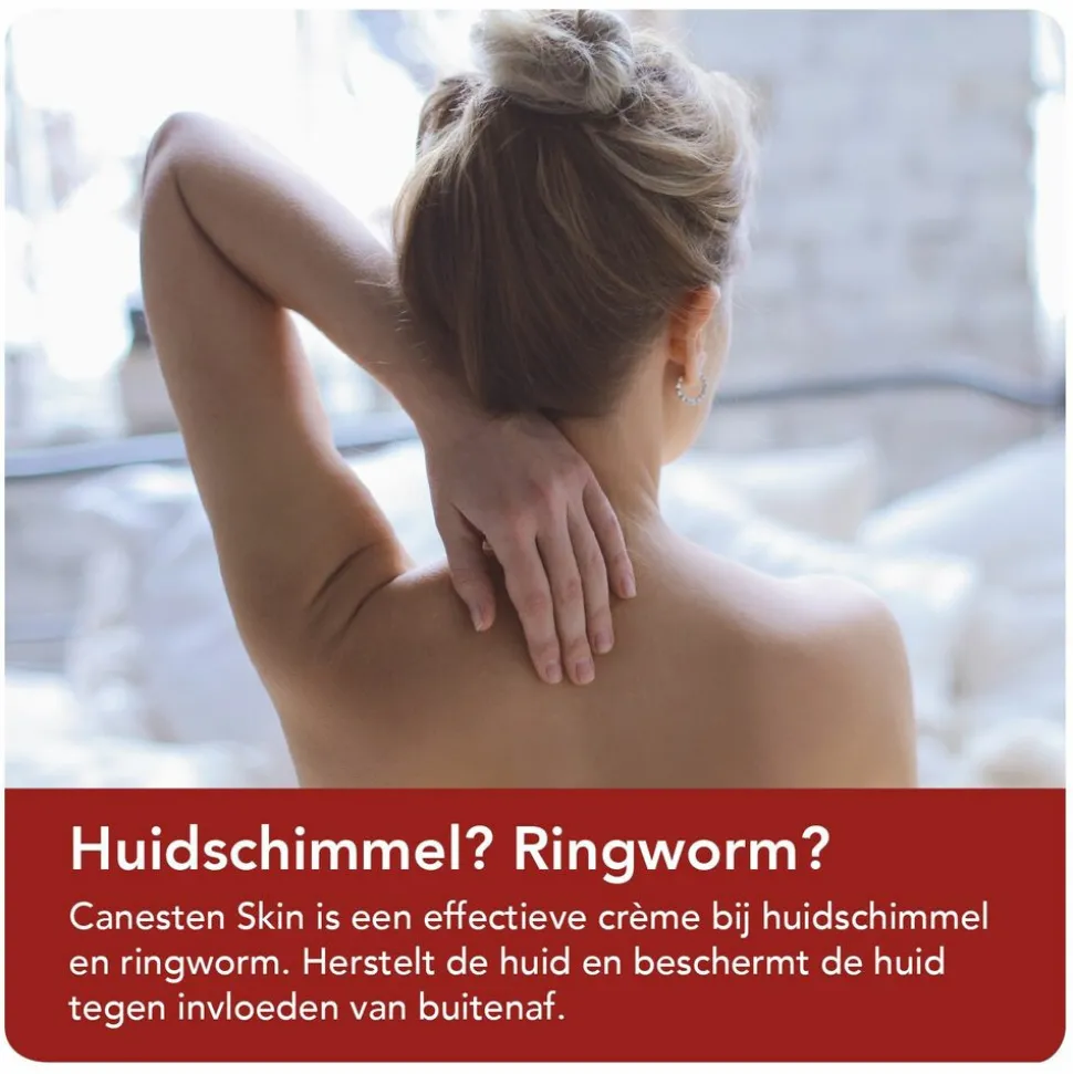 Canesten Skin Crème bij Huidschimmel 30 gr